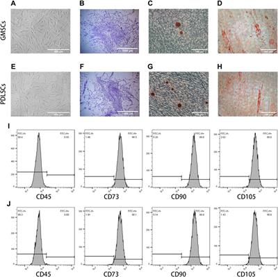 Exosomes Derived From Human Gingival Mesenchymal Stem Cells Attenuate the Inflammatory Response in Periodontal Ligament Stem Cells